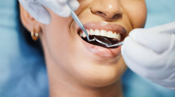 Best Emergency Wisdom Teeth Removal in Harvard, IL